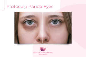 Protocolo Panda Eyes