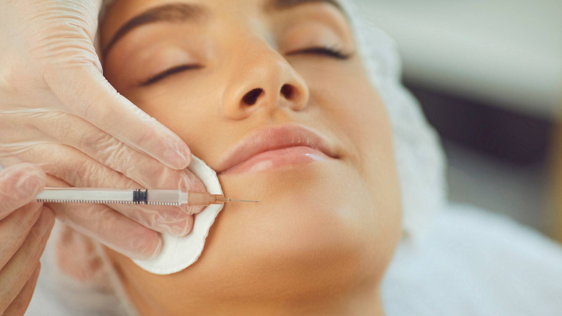 mulher sorrindo enquanto mão aplica botox abaixo dos lábios em um procedimento de harmonização facial